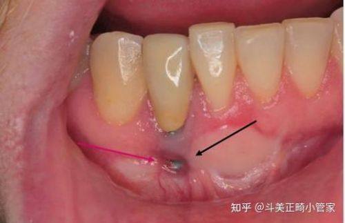 嘉兴桐乡松丰口腔价格表