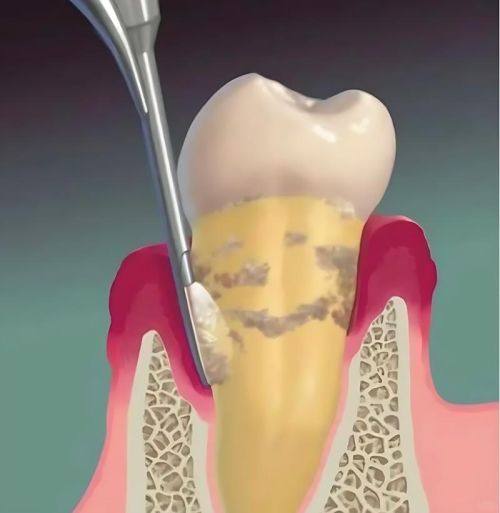 杨紫静医生技术优势