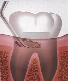 淳安千岛湖郑桃花口腔诊所价格表：