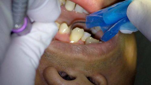 杨紫静医生擅长领域