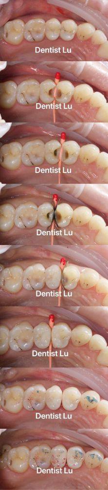 淳安千岛湖郑桃花口腔诊所擅长项目：