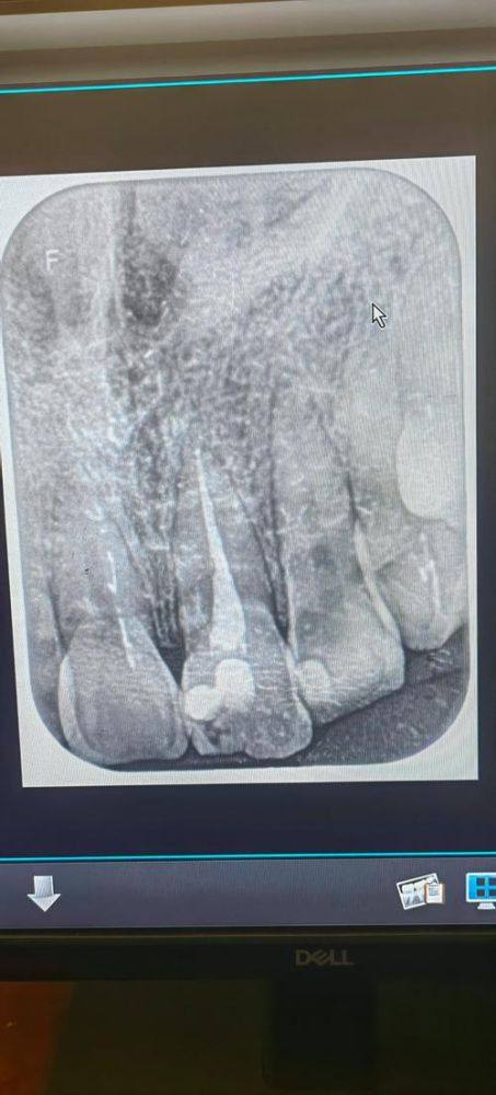 张艳芳医生口碑评价：