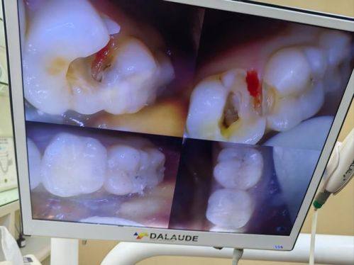 嘉兴桐乡松丰口腔预约挂号方式