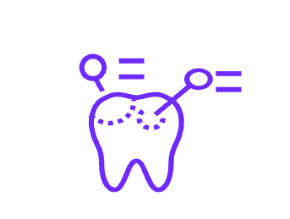 四、重度深龋/大面积龋洞缺损时需要根管治疗