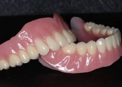 三、牙列拥挤的矫正方案有哪些？