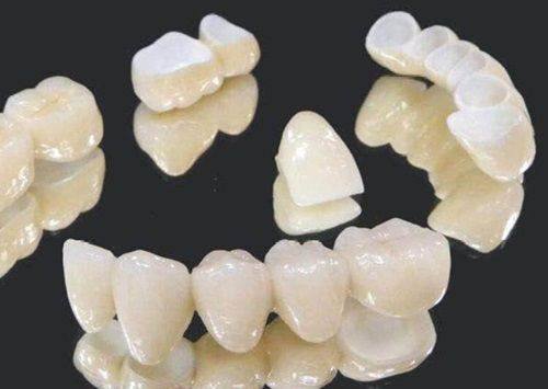 三、大牙根管治疗后需要打桩吗？