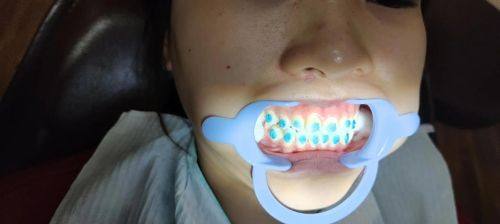 宋加明医生擅长领域