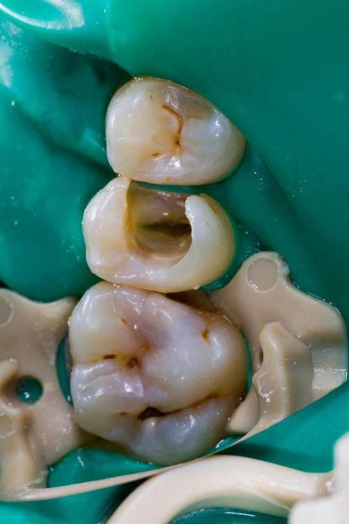 卢海林医生技术优势