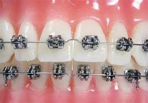 绍兴品凯口腔医院预约挂号方式：