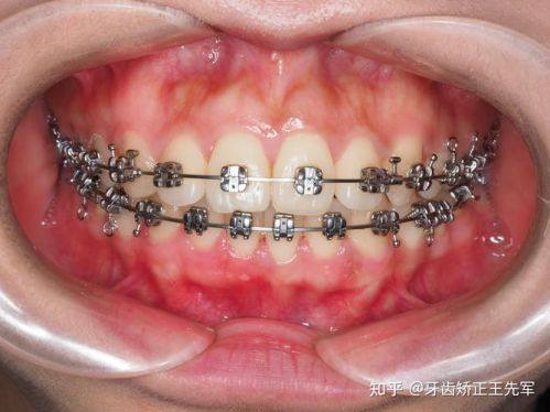 吴忠市红寺堡区微笑口腔门诊部预约挂号方式