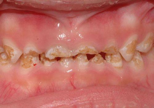 吴忠市红寺堡区微笑口腔门诊部地址电话及营业时间