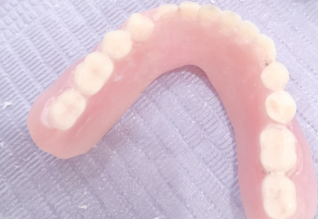 四、并非所有牙痛都需要根管治疗，警惕过度医疗