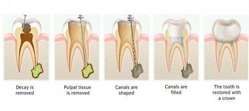 卢海林医生技术优势