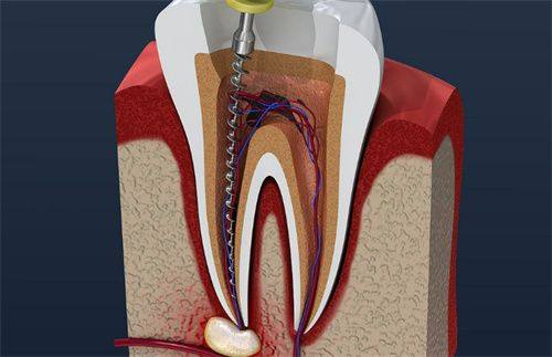 江苏泰兴牙博仕口腔口碑评价: