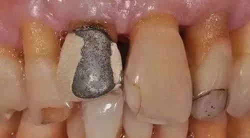 江苏泰兴牙博仕口腔怎么样?