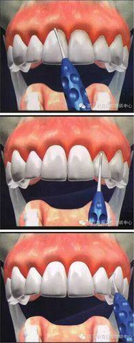 田晨医生口碑评价