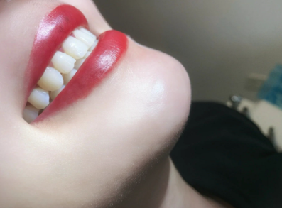 二、主流品牌全瓷牙的质保与寿命参数