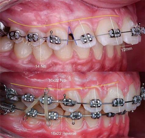 深圳汪洋齿科颜秀娟口腔诊所擅长项目