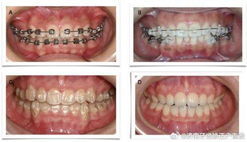 上海侯晓辉口腔地址电话及营业时间：