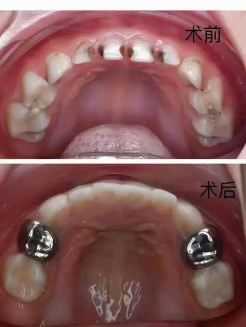 瑞博口腔医院价格表：