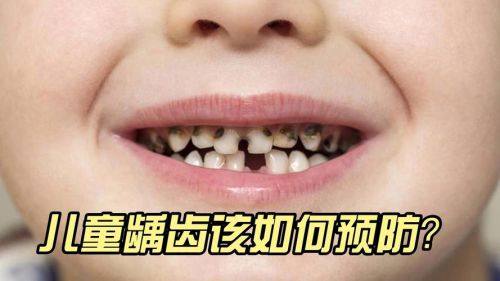 深圳汪洋齿科颜秀娟口腔诊所怎么样