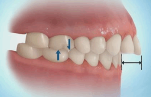 三、不同拔牙场景的时长差异详解