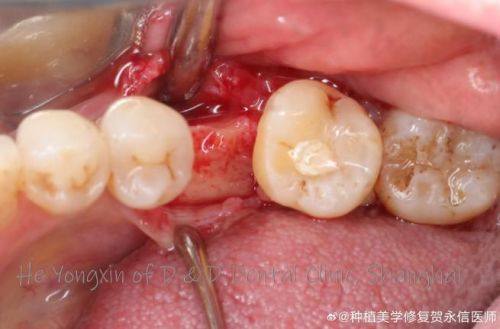 泉州雅如意口腔预约挂号方式：