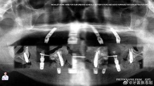 田晨医生擅长领域