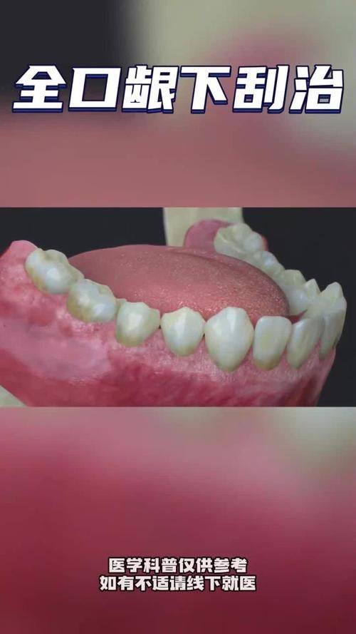 杨雨医生怎么预约