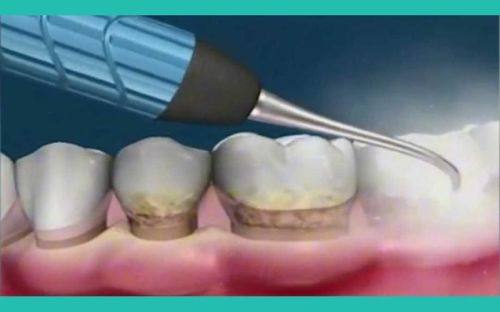 田晨医生怎么预约