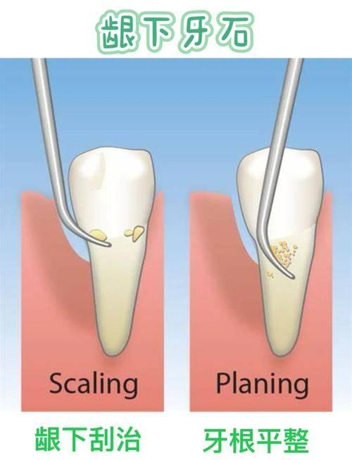 重庆奈斯特口腔诊所价格表