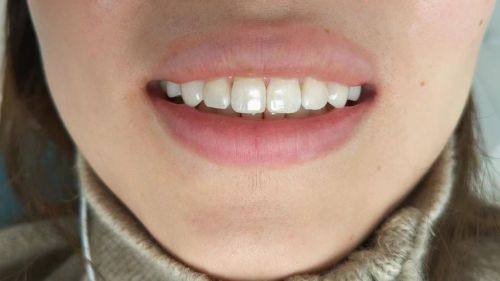 青岛西诺德口腔怎么样？