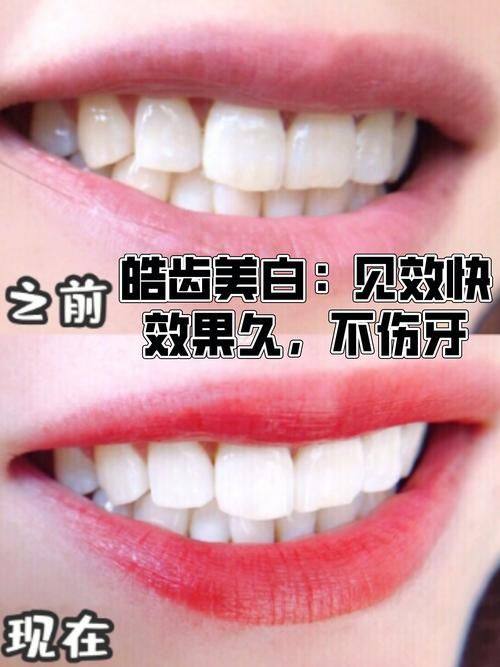 青岛西诺德口腔擅长项目：