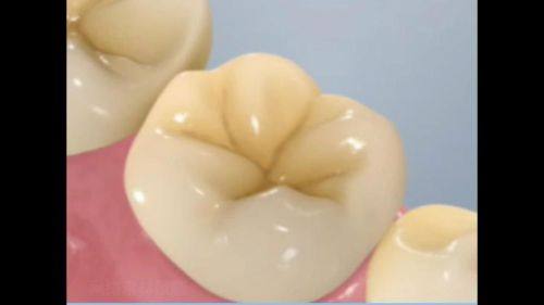 成都锦江文华思迈口腔价格表：