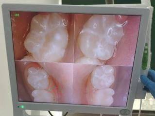 青岛西诺德口腔价格表：