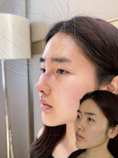 韩国POP整形外科预约挂号方式：