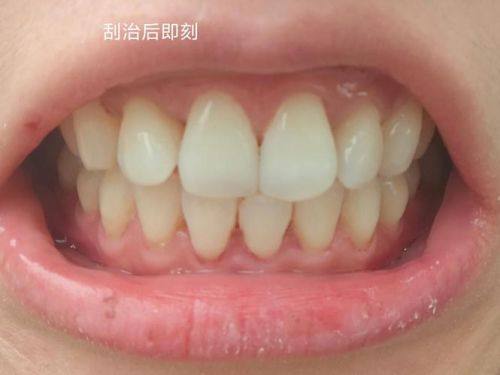 齐少玮医生擅长领域：