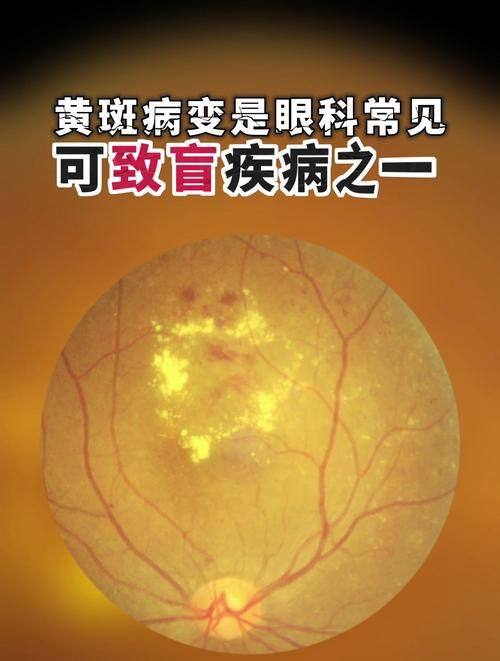 雅安市人民医院眼科预约挂号方式