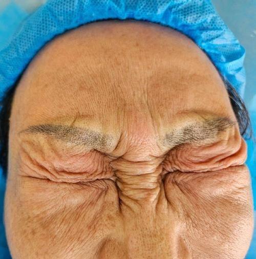 柳州医美整形医院价格表