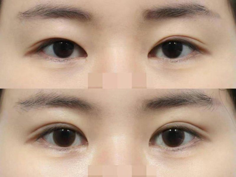 柳州医美整形医院怎么样？