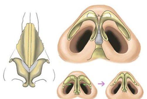 秦继军 医生擅长领域