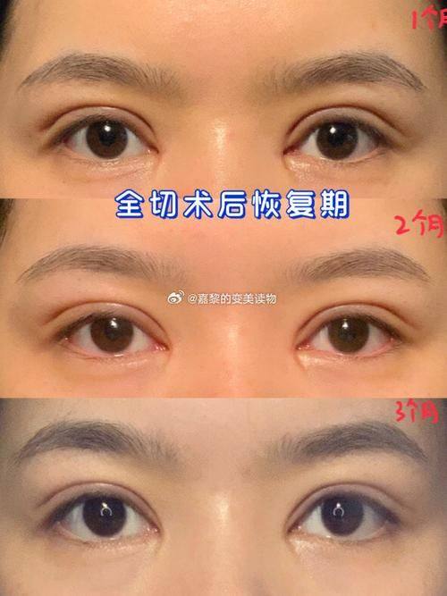 秦继军 医生技术优势