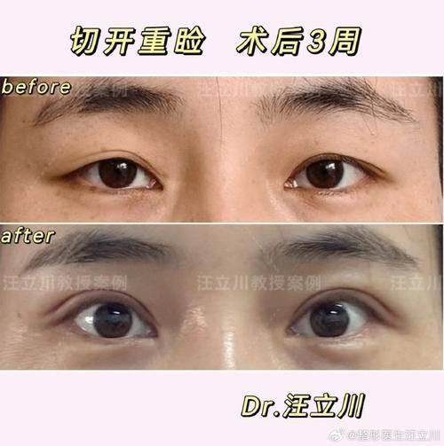 湖北孝感星诺整形预约挂号方式：