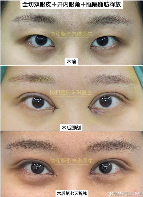 秦继军 医生怎么预约