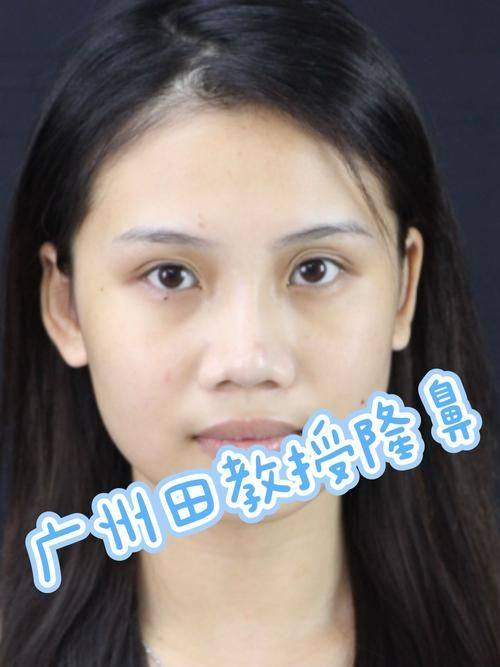 秦继军 医生口碑评价