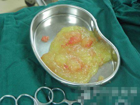 启东柠菲绎美整形医院擅长项目