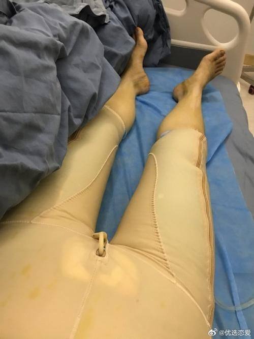 韩国品牌整形医院怎么样？