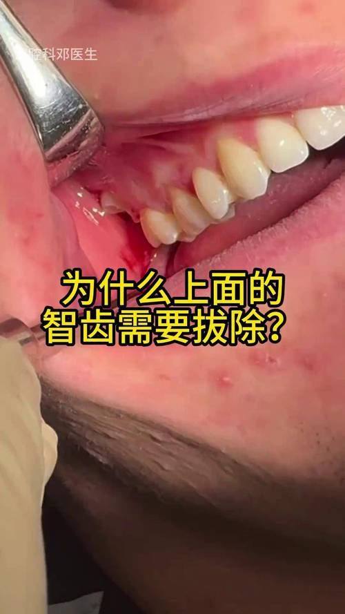 马福凯医生擅长领域