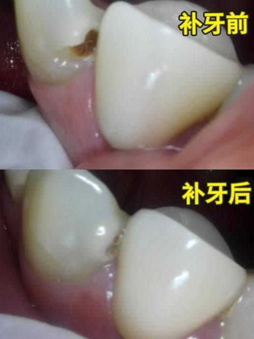青海红十字医院口腔科口碑评价：