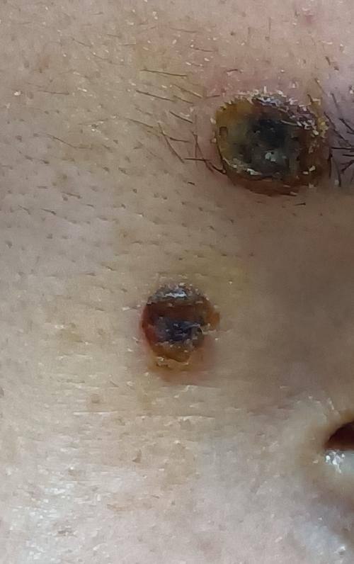 启东柠菲绎美整形医院价格表